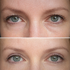 Instalift Pdrn Collagen Eye Patches Intensely Moisturizing And Hydrating